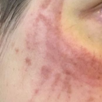 MD Skin : Spa Laser Aesthetics - Skin Care Near Me - Solana Beach, California MD Skin : Spa Laser Aesthetics - Skin Care Near Me - Solana Beach, California