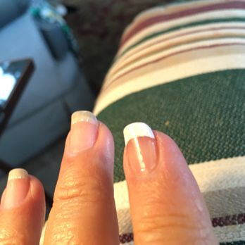 Nail Image - Peeling. Egan around cuticle. - Nail Salons Near Me - Nipomo, California Nail Image - Peeling. Egan around cuticle. - Nail Salons Near Me - Nipomo, California
