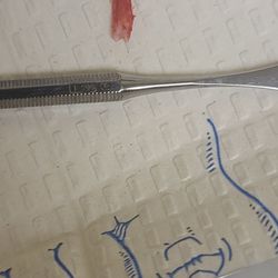 Benedict Ching, DPM - My ingrown toenail