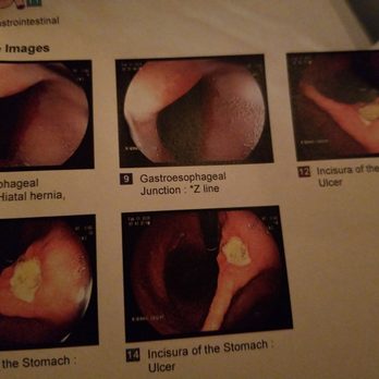 Jao Robert V, MD - These are new to me as I would never have thought I had gouges in my stomach and confirmed to be ulcers, ..still too long damnit - Gastroenterologist Near Me - Kailua, Hawaii
