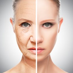 Skin Laser - SKIN TIGHTENING COMING SOON!