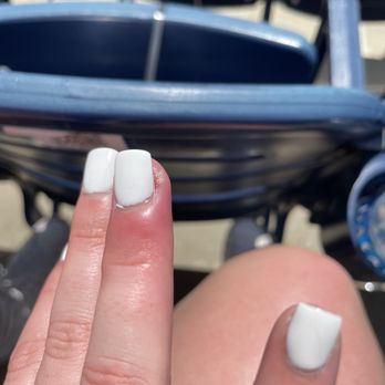 Nail Va - Infection 2 days after getting nails done. - Nail Salons Near Me - Yorktown, Virginia