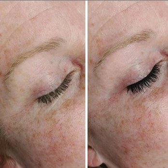 Onari Esthetics - Before & after/// eyelash tint - Waxing Near Me - North Hampton, New Hampshire