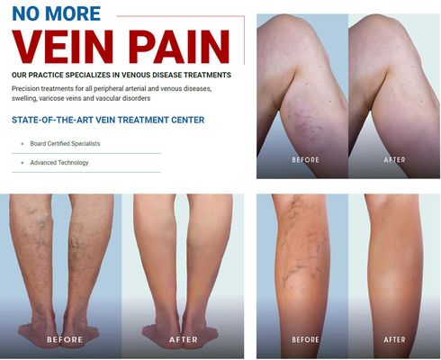 Vein Care Center