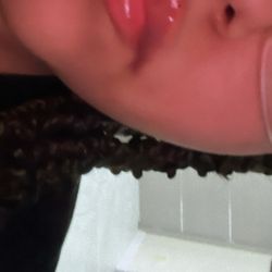 Lío fillers