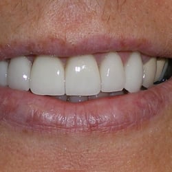 Laurence A Langer, DDS - Smile after
