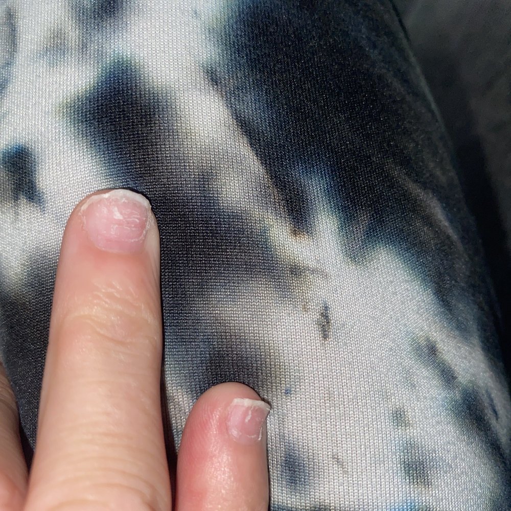 My nails are now paper thin My nails are now paper thin