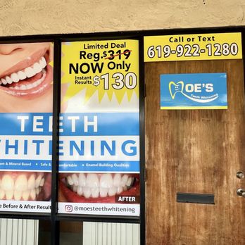 Moe's Teeth Whitening - Teeth Whitening Near Me - El Cajon, California Moe's Teeth Whitening - Teeth Whitening Near Me - El Cajon, California