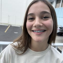 Freeman Orthodontics - Top braces