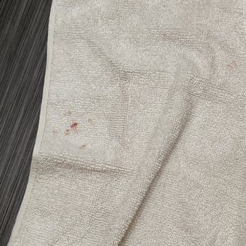 Lindsay Inn - Blood on towel? - Hotels Near Me - Lindsay, Texas Lindsay Inn - Blood on towel? - Hotels Near Me - Lindsay, Texas