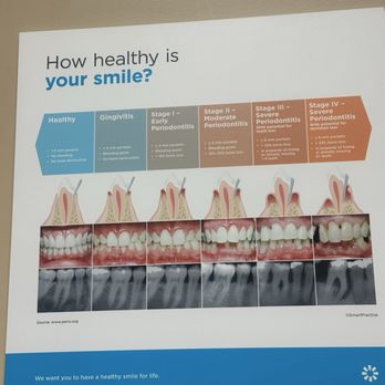 Menifee Smiles Dentistry - General Dentistry Near Me - Menifee, California Menifee Smiles Dentistry - General Dentistry Near Me - Menifee, California