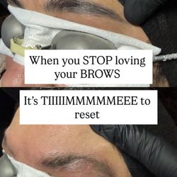 Un-Ink'd by Marisabel - Laser Tattoo Removal