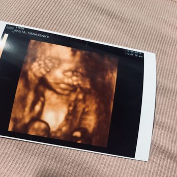 TomorrowToday Ultrasound - Ultrasound Imaging Centers Near Me - Aiea, Hawaii TomorrowToday Ultrasound - Ultrasound Imaging Centers Near Me - Aiea, Hawaii