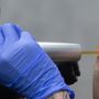 Photo of Removery Tattoo Removal & Fading