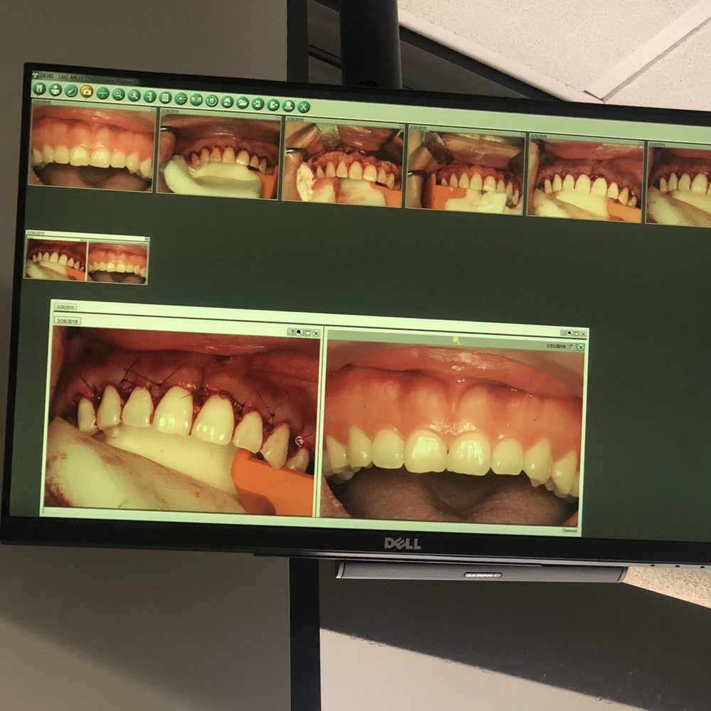 Smiles make over before & after