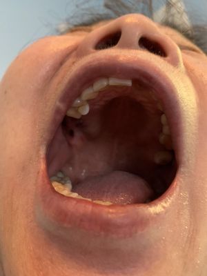ACCELLENT DENTAL - Updated March 2026 - 21 Reviews - 3907 Prince St ...