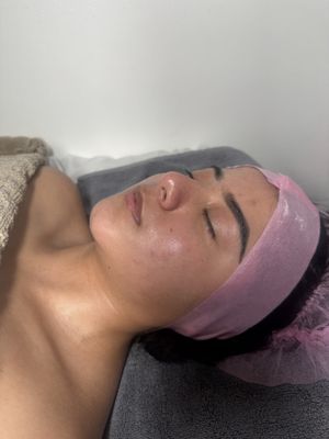 ✨ Servicios de Microneedling ✨ - Sobre Mí
Hola, soy Cinthia, profesional licenciada en estética con más de [X] años de experiencia en el mundo del cuidado de la piel. Estoy certificada en microneedling y me mantengo actualizada con las últimas técnicas y protocolos de seguridad para ofrecerte los mejores resultados. Mi misión es ayudarte a sentirte segur@ y bell@ en tu propia piel.

¿Qué es el Microneedling?
El microneedling, también conocido como terapia de inducción de colágeno, es un tratamiento mínimamente invasivo que utiliza microagujas para crear pequeñas perforaciones en la piel. Este proceso estimula la respuesta natural de curación del cuerpo, aumentando la producción de colágeno y elastina para una piel más saludable y joven.

Beneficios del Microneedling
✅ Reduce líneas finas y arrugas
✅ Mejora la textura y el tono de la piel
✅ Disminuye cicatrices de acné y estrías
✅ Reduce el tamaño de los poros
✅ Mejora la absorción de productos
✅ Estimula la producción de colágeno y elastina
✅ Seguro para todo tipo de piel con poco tiempo de recuperación

¿Por Qué Elegirme?
🌟 Profesional Licenciada – Totalmente certificada y capacitada en microneedling y salud de la piel.
🌟 Tratamientos Personalizados – Cada sesión se adapta a tus necesidades y objetivos específicos.
🌟 Ambiente Seguro y Limpio – Sigo protocolos estrictos de higiene y seguridad.
🌟 Apasionada por los Resultados – Me importa tu proceso y estoy aquí para acompañarte en cada paso.