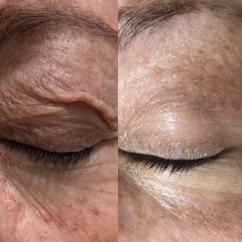 Synolo Aesthetics & Wellness - Skin Care Near Me - Naples, Florida Synolo Aesthetics & Wellness - Skin Care Near Me - Naples, Florida