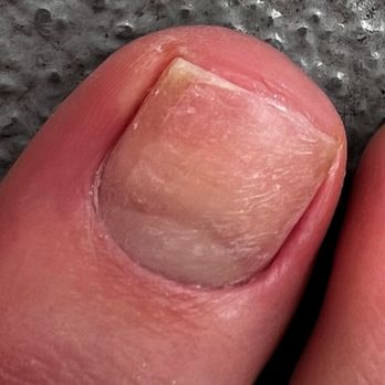 Nail club - That's from her attempting to remove regular polish with the nail file - like what?!?! This is pure ew. I need nail rehab - Nail Salons Near Me - Los Angeles, California