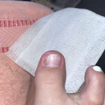 Natural Nails - Left over ingrown . - Nail Salons Near Me - Fontana, California