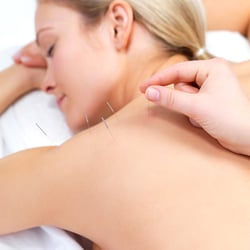 Jill Booth Acupuncture & Wellbeing