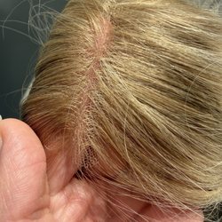 Jewell clip - Hybrid hairline topper