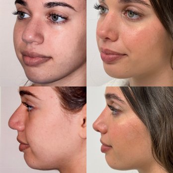 Thomas W Loeb, MD - Cosmetic Surgeons Near Me - New York, New York Thomas W Loeb, MD - Cosmetic Surgeons Near Me - New York, New York