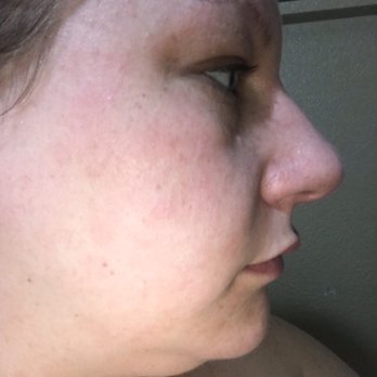 Skin by Jessica - March 2019 - Skin Care Near Me - Turlock, California Skin by Jessica - March 2019 - Skin Care Near Me - Turlock, California