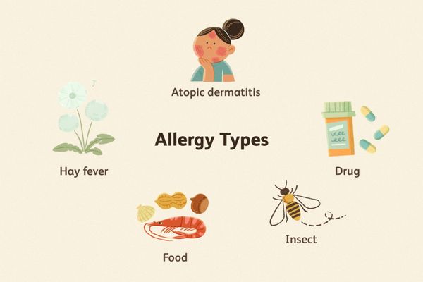 Allergy Treatment Available - Allergy treatment includes avoidance of triggers, antihistamines, decongestants, corticosteroids for symptom relief, and immunotherapy to build tolerance. Emergency care with epinephrine for severe reactions. Consult a healthcare provider for personalized management. Allergy Treatment Available - Allergy treatment includes avoidance of triggers, antihistamines, decongestants, corticosteroids for symptom relief, and immunotherapy to build tolerance. Emergency care with epinephrine for severe reactions. Consult a healthcare provider for personalized management.