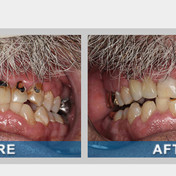 Whites Creek Dental