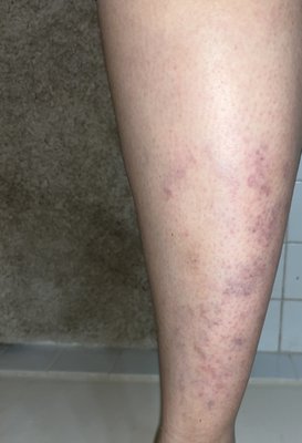 Sugaring NYC - Warren