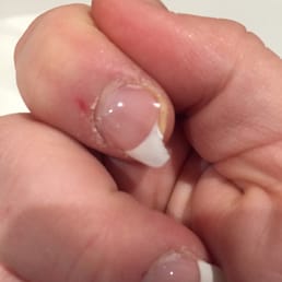 Chipped Nail