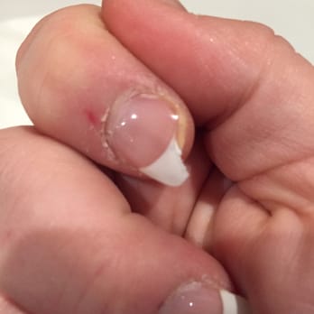 Luxury Nails - Chipped Nail - Nail Salons Near Me - Appleton, Wisconsin