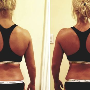Fixed By KG - Before and After 1x session FIXED right shoulder - Massage Therapy Near Me - Las Vegas, Nevada Fixed By KG - Before and After 1x session FIXED right shoulder - Massage Therapy Near Me - Las Vegas, Nevada