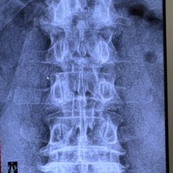 Kaplan Family Chiropractic - Digital x-rays performed on site