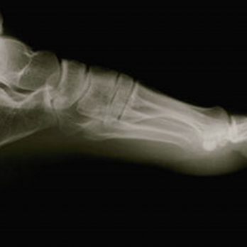 Seth Kane, MD - Sports Medicine Near Me - Oradell, New Jersey