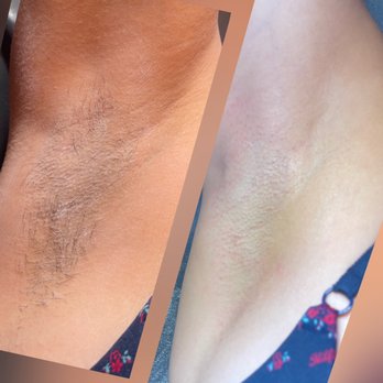 Be Esthetics Beauty - Underarm Wax - Skin Care Near Me - Phoenix, Arizona