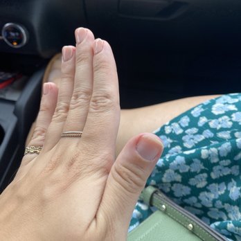 Spa Santé - This was 1 day after getting a dip manicure. - Day Spas Near Me - New York, New York Spa Santé - This was 1 day after getting a dip manicure. - Day Spas Near Me - New York, New York