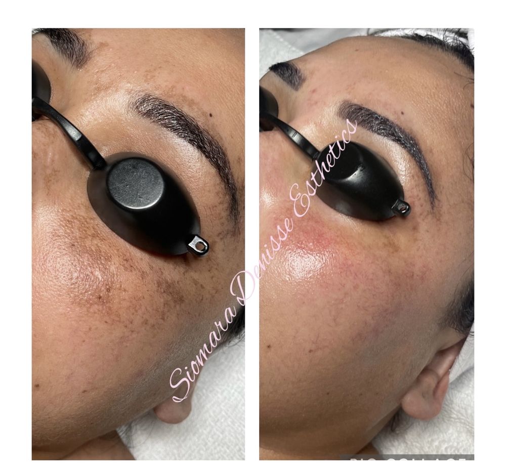 Siomara Denisse Esthetics Logo