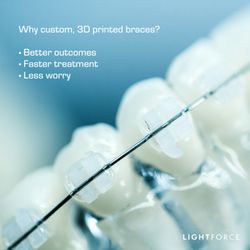 Covino Orthodontics - Proud to offer custom clear braces