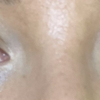 Bless Lash - One eye is good. The other one has 4 lashes left - The image shows a close-up of a person's eyes, focusing on the eyelids and eyelashes. One eye has four lashes left, while the other eye appears to have a full set of lashes. The skin around the eyes is visible, and the person has brown irises and long eyelashes. - Eyelash Service Near Me - Queens, New York