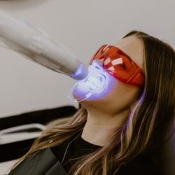 SmileNova Teeth Whitening