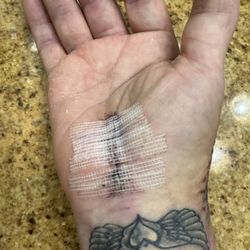 Volusia Hand Surgery Clinic