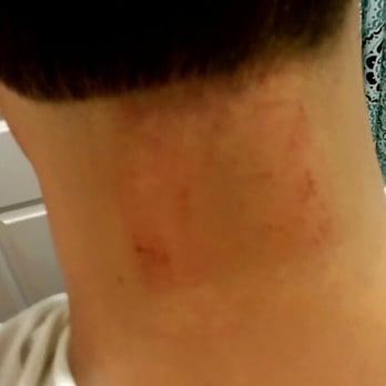 Barber's BluePrint - Painful scraped-up neck following haircut... - Barbers Near Me - New York, New York