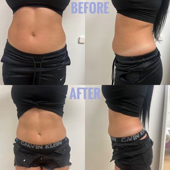 Sandy Esthetics - Body Countoring - Estheticians Near Me - Miami, Florida Sandy Esthetics - Body Countoring - Estheticians Near Me - Miami, Florida