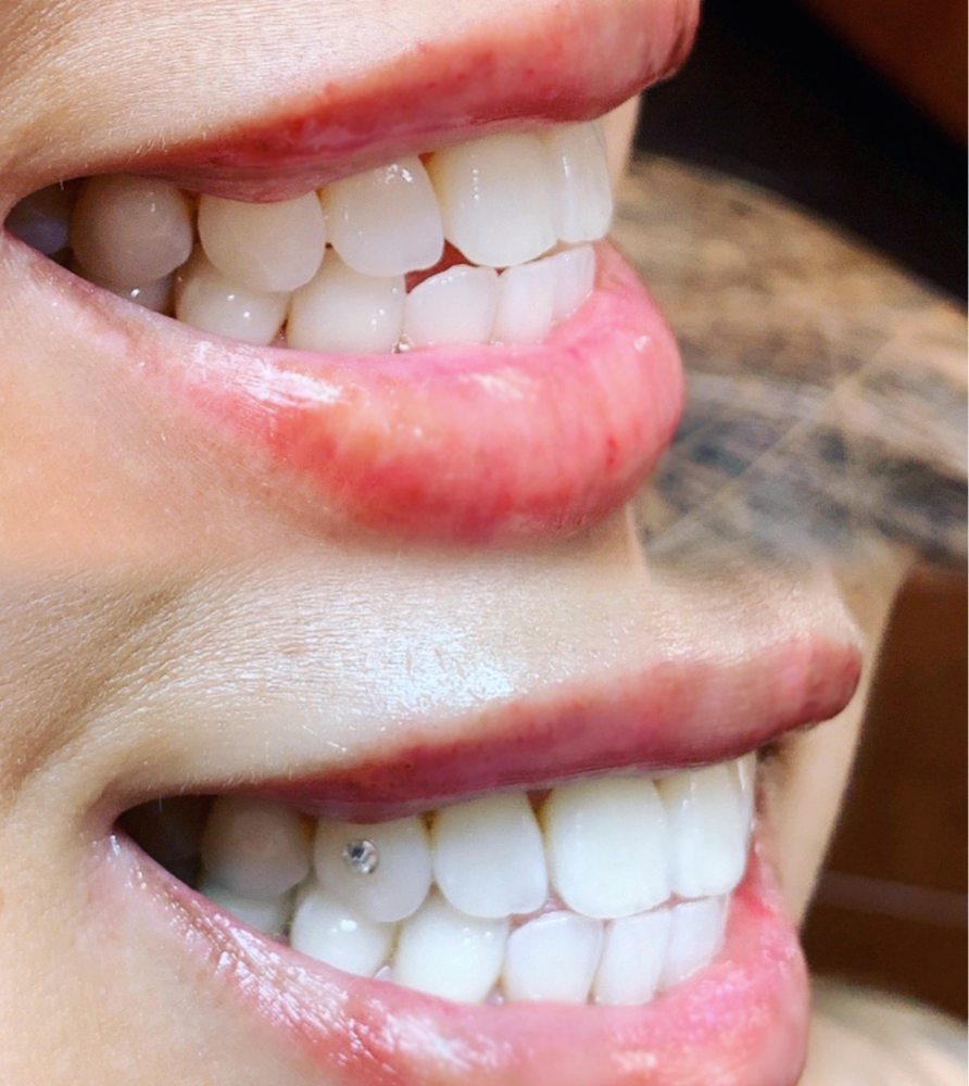 SoCal Electrolysis Logo