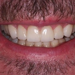 SmileCare Dental
