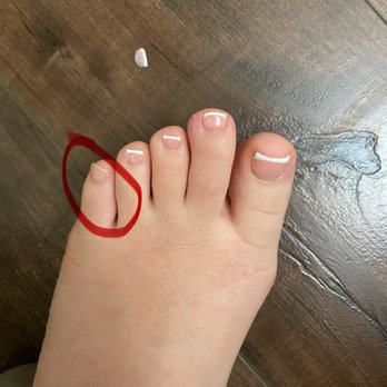 North Park Nail Lounge - Gel of pinky toe on left foot popped off 2 days after service - Nail Salons Near Me - San Diego, California North Park Nail Lounge - Gel of pinky toe on left foot popped off 2 days after service - Nail Salons Near Me - San Diego, California