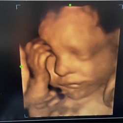 Wonderful reveals - 4d Ultrasound with Wonderful revelas #statenisland