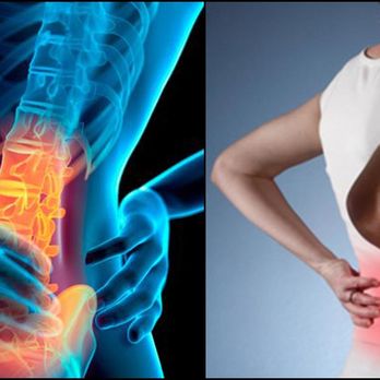 Seth Klein, DC - Seth Klein, DC - Chiropractors Near Me - Coral Springs, Florida Seth Klein, DC - Seth Klein, DC - Chiropractors Near Me - Coral Springs, Florida